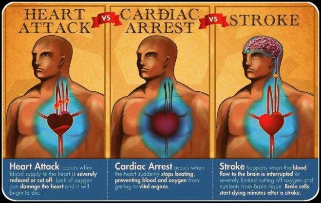 Heart Attack vs Cardiac Arrest vs Stroke
